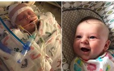 Tai nạn khó tin: Bé gái nguy kịch vì quả bóng chày bay trúng đầu khi đang bú