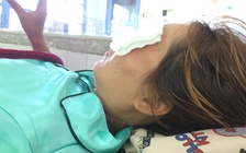 Nguy cơ mù mắt sau tiêm filler ở spa không phép