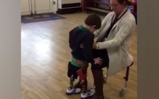 Cậu bé 7 tuổi mất cả hai chân đã đi lại được bằng chân giả