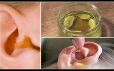 Nhiễm trùng tai: Bạn đã biết cách làm giảm đau chưa?