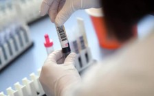 Xu hướng xét nghiệm Covid-19 theo nhóm