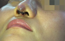 Tin tay ngang, mang tai họa