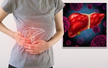 Phương pháp điều trị mới hiệu quả với 88% bệnh nhân ung thư gan