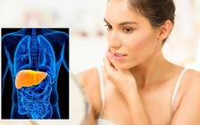 Gan nhiễm mỡ: Dấu hiệu trên mặt cảnh báo bệnh đã nghiêm trọng!