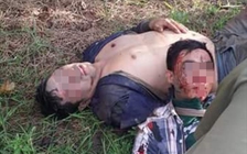 Một trong hai nghi can trộm chó bị đánh bầm dập ở Biên Hòa nhiễm HIV