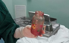 Người đàn ông nhét bình sữa vào... hậu môn để trị thoái hóa cột sống