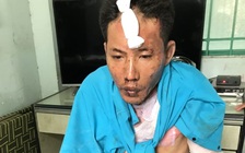 Chồng hờ tưới xăng đốt vợ cùng 2 con riêng