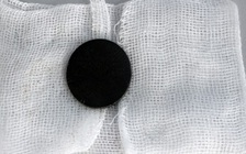 Nằm tung đồng xu lên cao, bé trai bị đồng xu... chui vào bụng