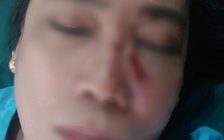 Dừng đèn đỏ, một giáo viên bị ném đá vào mặt