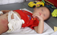 Bé trai 5 tuổi bị cậu ném vào đống lửa vì tranh nhau quả dưa chuột