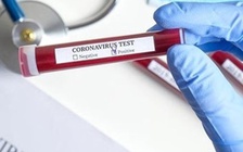 Nữ công nhân quê Hải Dương dương tính Covid-19 khi sang Nhật