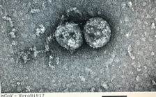 Bộ Y tế: SARS-CoV-2 thường xuyên biến đổi tạo nên các biến chủng lây lan nhanh hơn