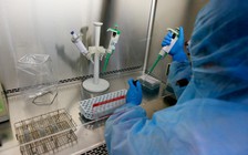 Thừa Thiên - Huế: Đã có kết quả xét nghiệm 15 người tiếp xúc gần với BN Covid-19 thứ 30