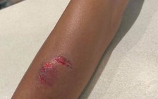 Nữ hành khách cắn rách tay nhân viên hàng không vì bị nhắc hành lý quá cân