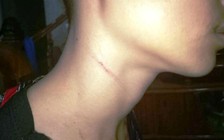 Công an vào cuộc xác minh vụ việc một hiệu trưởng bị 'tố' bóp cổ học sinh