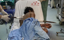 Cứu sống người đàn ông bị xà beng dài hơn 1 m đâm xuyên ngực