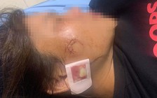 Thanh Hóa: Điều tra nghi án nổ súng khiến một phụ nữ bị thương