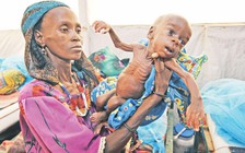 Báo động tình trạng suy dinh dưỡng, béo phì ở trẻ em