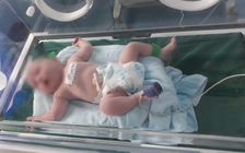 Vụ thai phụ tự thiêu vì giận chồng: Mổ cứu thai nhi