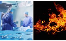 Bệnh nhân thành 'đuốc sống' do sơ suất của bác sĩ phẫu thuật