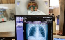 Khó khăn vì bị cấm vận, Iran tự phát minh phần mềm AI chẩn đoán Covid-19