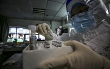 Trung Quốc, Hàn Quốc ghi nhận số ca mắc Covid-19 tăng vọt