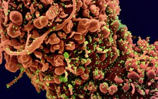 Virus Corona gây tổn hại tinh hoàn dù không xâm nhập