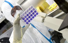 WHO cảnh báo khó có vắc xin hoàn hảo giúp chặn đứng Covid-19