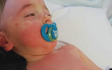 Cảnh báo viêm đa hệ thống chết người ở trẻ em nếu mắc Covid-19