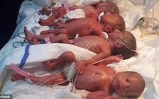 Hy hữu một thai phụ sinh 9 bé, mẹ tròn con vuông