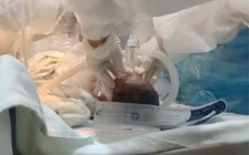 Hy hữu sản phụ mắc Covid-19 sinh bé trai không mắc bệnh