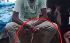 Quấn rắn quanh cổ để ra vẻ, người đàn ông bị rắn cắn chết