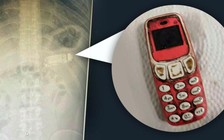 Phạm nhân nuốt điện thoại 'cục gạch', bác sĩ phải nội soi lấy ra