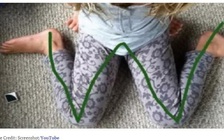 Tránh cho trẻ ngồi tư thế chữ W