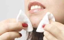 Tại sao không nên nặn mụn?