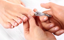 Những cách tự nhiên chữa móng mọc đâm khóe