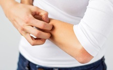 Bốn dấu hiệu 'tố cáo' gan của bạn có vấn đề