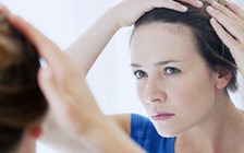 Mái tóc tiết lộ bí mật sức khỏe của bạn