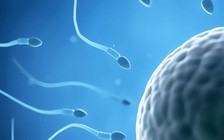 Thụ tinh nhầm tinh trùng