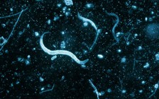 Những dấu hiệu nhận biết bạn đang bị giun sán