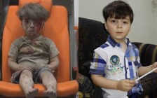 Cậu bé Syria đẫm đất cát và máu nay rất đáng yêu, khỏe mạnh