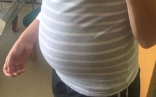 Tưởng mang thai, nào ngờ bị u nang buồng trứng nặng