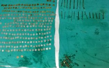 Nuốt 7 kg kim loại vào bụng