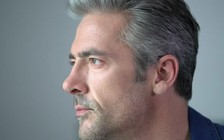 Hói đầu, bạc tóc tuổi đôi mươi làm tăng nguy cơ mắc bệnh tim