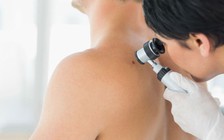 Cẩn trọng khi dùng thuốc điều trị huyết áp cao