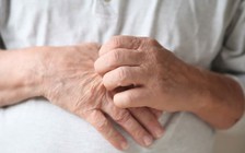 Tắm với nước thường cũng hiệu quả để trị chàm