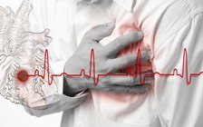 Hệ thống trí tuệ nhân tạo giúp chẩn đoán bệnh tim nhanh hơn