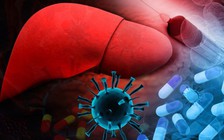 Những lưu ý trong ăn uống ở người bị viêm gan C