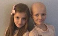 Em song sinh không mắc ung thư nhưng lại có triệu chứng ung thư của chị