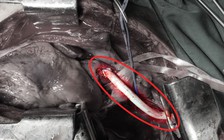 Cứu sống người bị tai nạn giao thông mất 4,2 lít máu